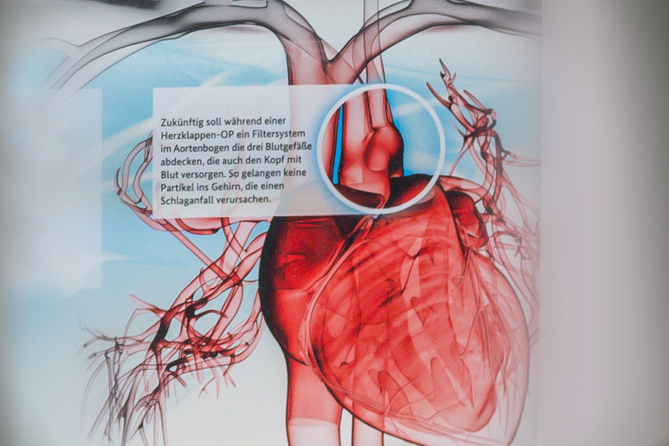 Eine Membran wird so platziert, dass sie drei Gefäße abdeckt.