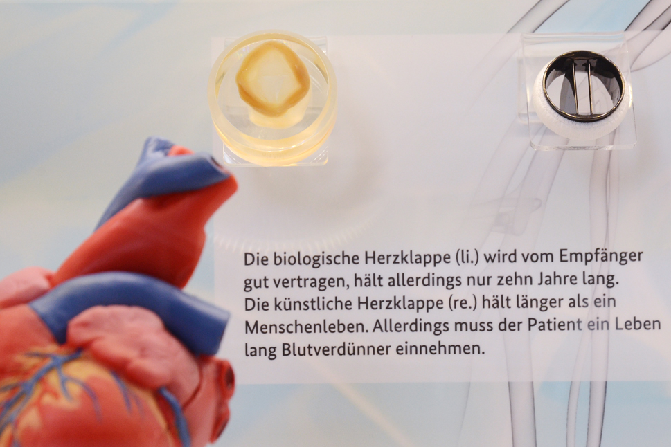 Eine biologische und eine künstliche Herzklappe im Vergleich.