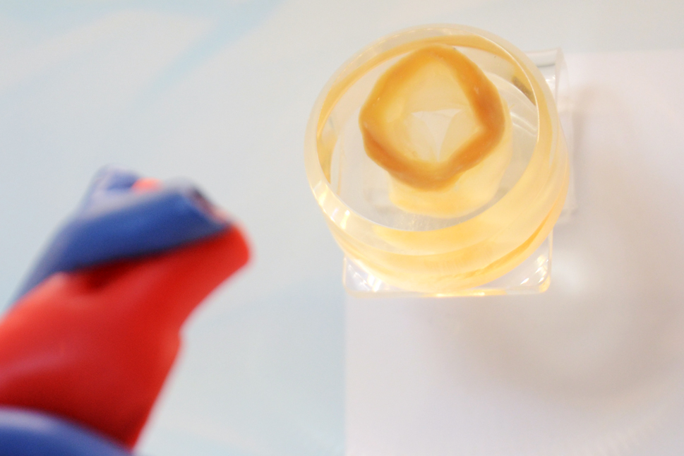 Nahaufnahme einer biologischen Herzklappe.